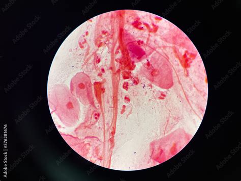 Bacteria cell in sputum sample Gram stain method. Stock Photo | Adobe Stock