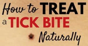 How to Treat a Tick Bite Naturally - What to Do After Removing a Tick