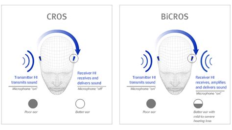 What is a Cros hearing aid? | Claso