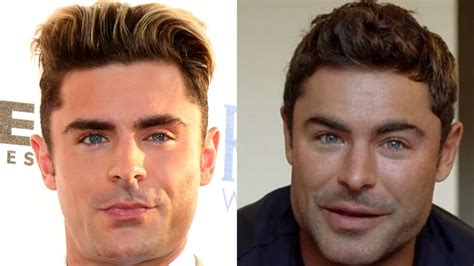 Zac Efron reveals what led to plastic surgery rumors after viral photos ...