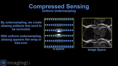 Compressed Sensing | MRI Compressed sensing is a newer acceleration ...