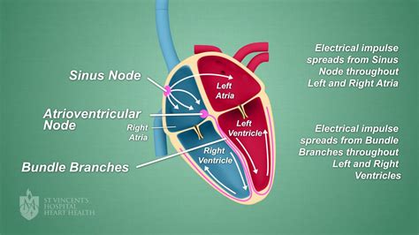 Dysrhythmia and Are Used to Describe Abnormal Heart Rhythm