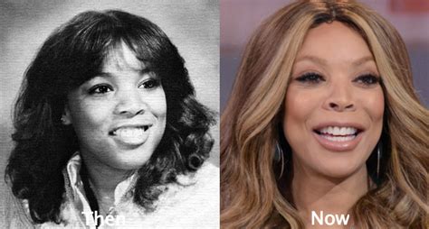 Wendy Williams Plastic Surgery Before and After Photos