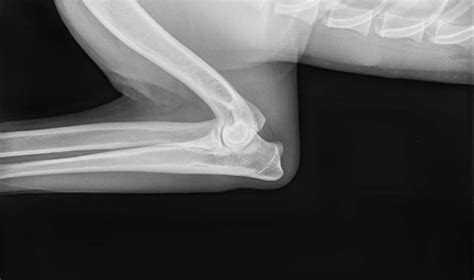 Elbow Dysplasia in Dogs | Great Pet Care