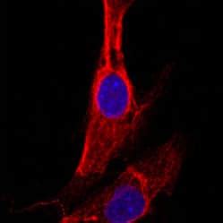 Fibroblast Cell Markers | Research Areas: Novus Biologicals