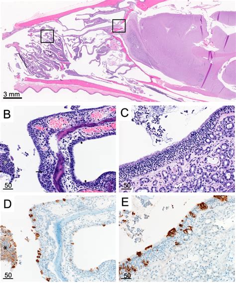 Nasal turbinate pathology and histopathology. (A) Sagittal section of ...