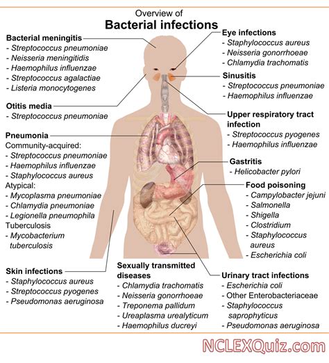 Overview of the Bacterial Infections Chart - NCLEX Quiz