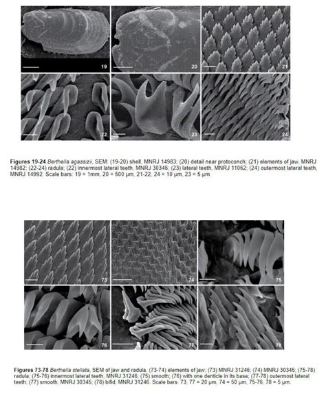 Phylum: Mollusca & their radula | Cephalopod Radula under the SEM