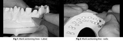 Morphology: Traditional Wax-up Technique for Anterior and Posterior ...