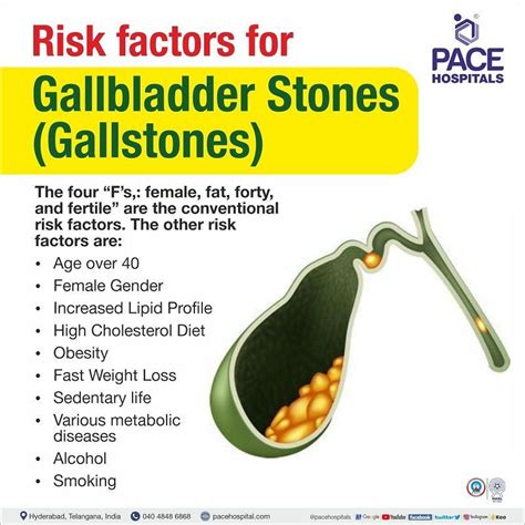 Gallstones, Gallbladder Stones – Symptoms, Causes, Complications