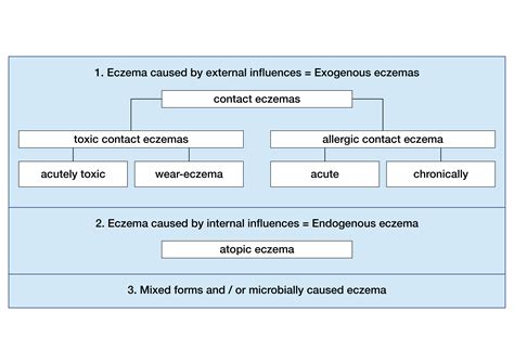 Eczema, Dermatitis - Marly Skin