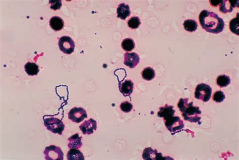 Streptococcus Bacteria - Classification, Shape, Infection & Gram Stain