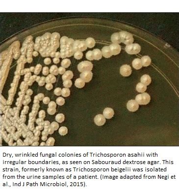 Trichosporon - Infections, Diagnosis & Treatment