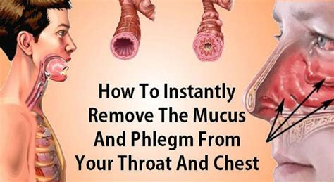 How to Eliminate Mucus and Phlegm from the Throat and Chest (Immediate ...