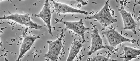 Yeast Contamination Cell Culture