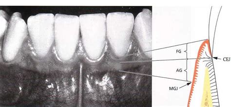 Dentistry lectures for MFDS/MJDF/NBDE/ORE: Note on Anatomy and ...