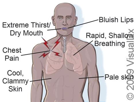 Medical Shock Symptoms