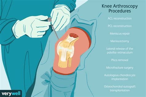 Arthroscopy surgeon in Jaipur, Shoulder surgeon in Jaipur, Joint clinic ...