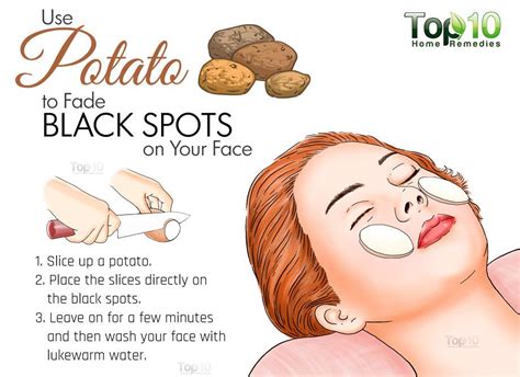 Home Remedies to Get Rid of Dark Spots - eMediHealth | Dark spots on ...