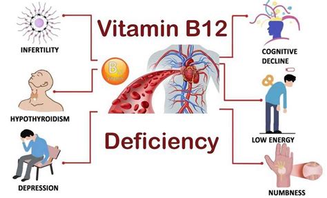 Vitamin B12 deficiency, causes, signs, symptoms, diagnosis, treatment ...