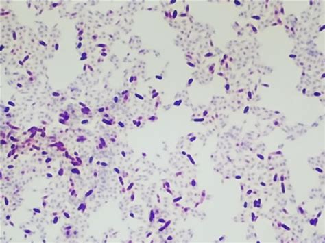 How To Set-Up And Conduct An Acid Fast Stain • Ethos Biosciences