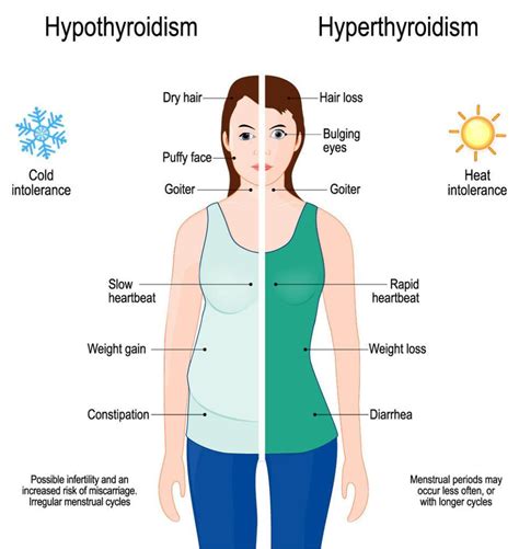 thyroid eye disease symptoms - DrBeckmann