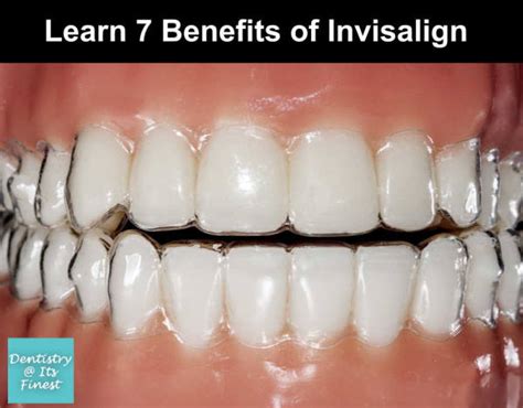 Know 7 Benefits of Invisalign Teeth Aligners - Dentistry At Its Finest