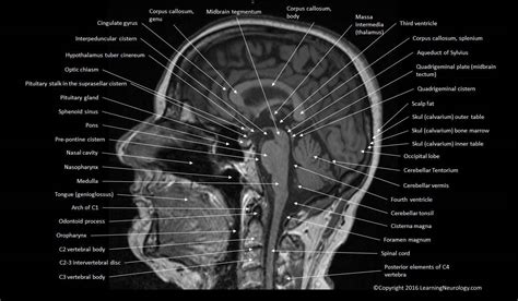 Brain Atlas Of Human Anatomy With Mri Mri Brain Mri Anatomy | Images ...