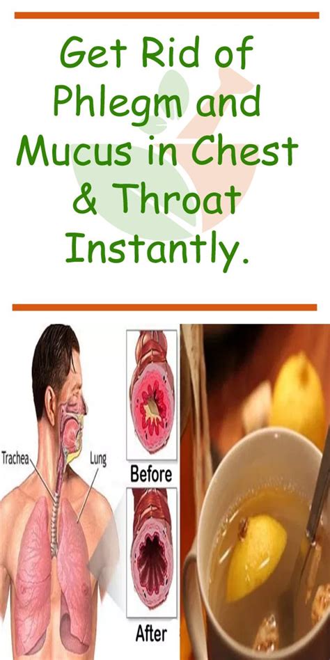 Get Rid of Phlegm and Mucus in Chest & Throat Instantly | Getting rid ...