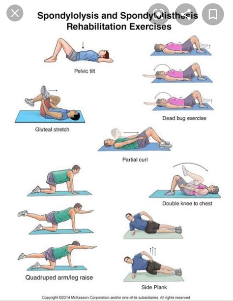 Physical Therapy Exercises For Lumbar Scoliosis Exercise Poster ...