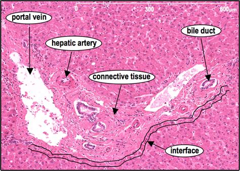 HistoQuarterly: LIVER