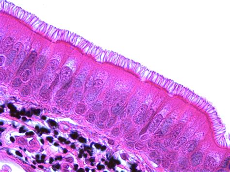 Pseudostratified Ciliated Columnar Epithelium | Human anatomy and ...