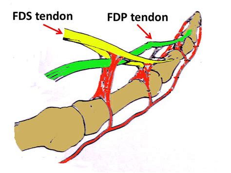 Flexor Tendon Injuries