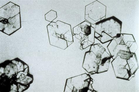 Cystine Crystals in Urine | Medical Laboratories