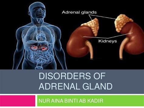 Disorders of adrenal gland