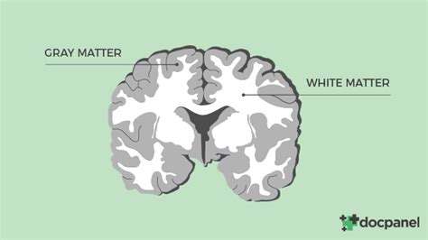 Navigating a White Matter Disease Diagnosis