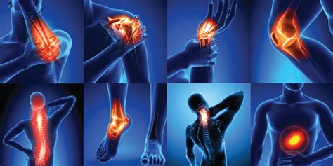 Blog | What You Need to Know About Joint Pain