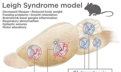 Two groups of neurons identified in causing Leigh syndrome