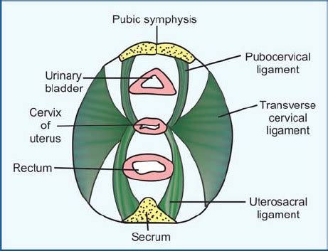 Transverse Cervical Ligament Of Uterus