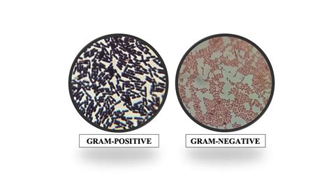 GRAM STAINING: GRAM-POSITIVE VS GRAM-NEGATIVE BACTERIA - Learn Life Science