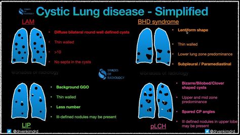 Lung cysts in Systemic diseases - YouTube