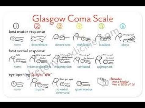 Glasgow Coma Scale ( GCS) - Assessment and Scoring - YouTube