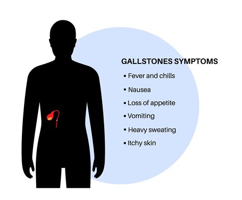 Gallstones: Types, Risk, Causes, Symptoms, and Treatment Options