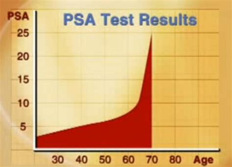 PSA Normal Range By Age, Causes of High Levels