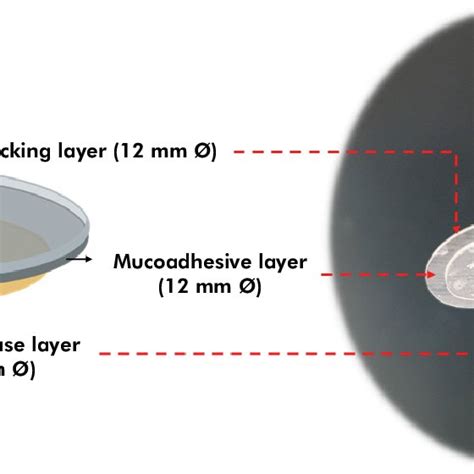 Mucoadhesive patches used in the clinical evaluation of the efficacy of ...