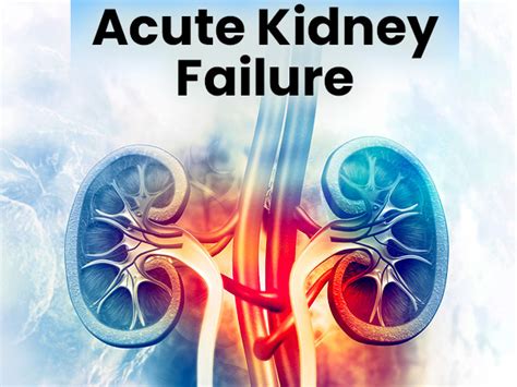 Acute Kidney Injury (Acute Kidney Failure): Causes, Symptoms, Risk ...