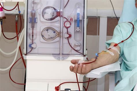 Dialysis: Procedure, purpose, types, side effects, and more