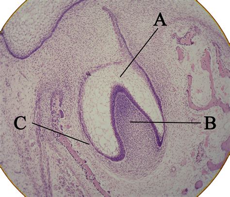 Tooth development - wikidoc