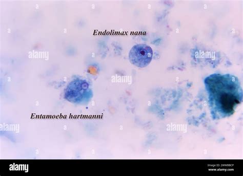 This photomicrograph revealed the presence of both an Entamoeba ...