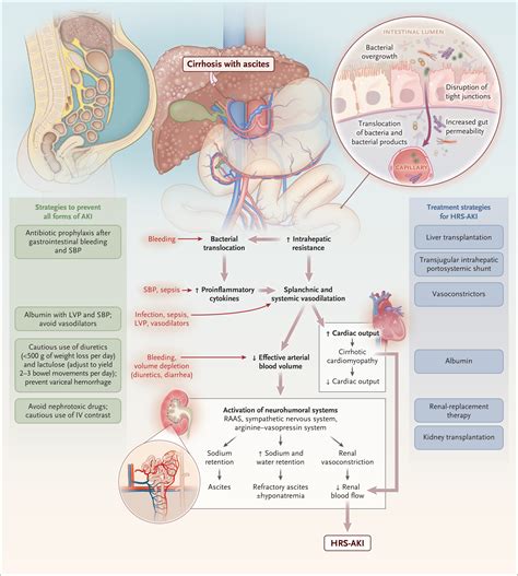 Acute Kidney Injury in Patients with Cirrhosis | NEJM